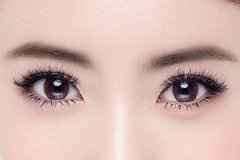 双眼皮吸脂的优势 双眼皮吸脂安全吗