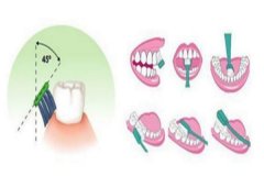 洗牙后的注意事项 洗牙对身体有伤害吗